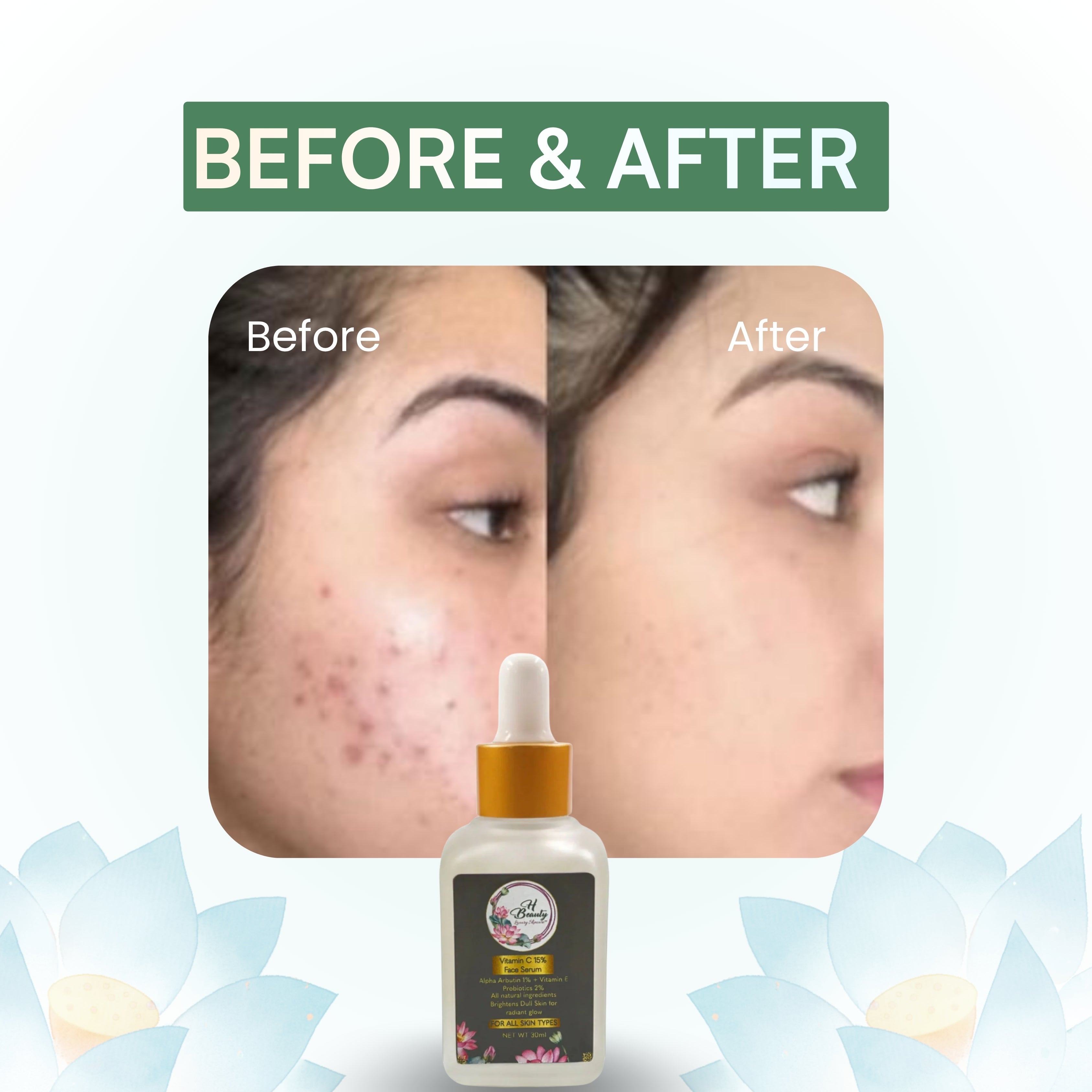 Vitamin C 15% Face Serum