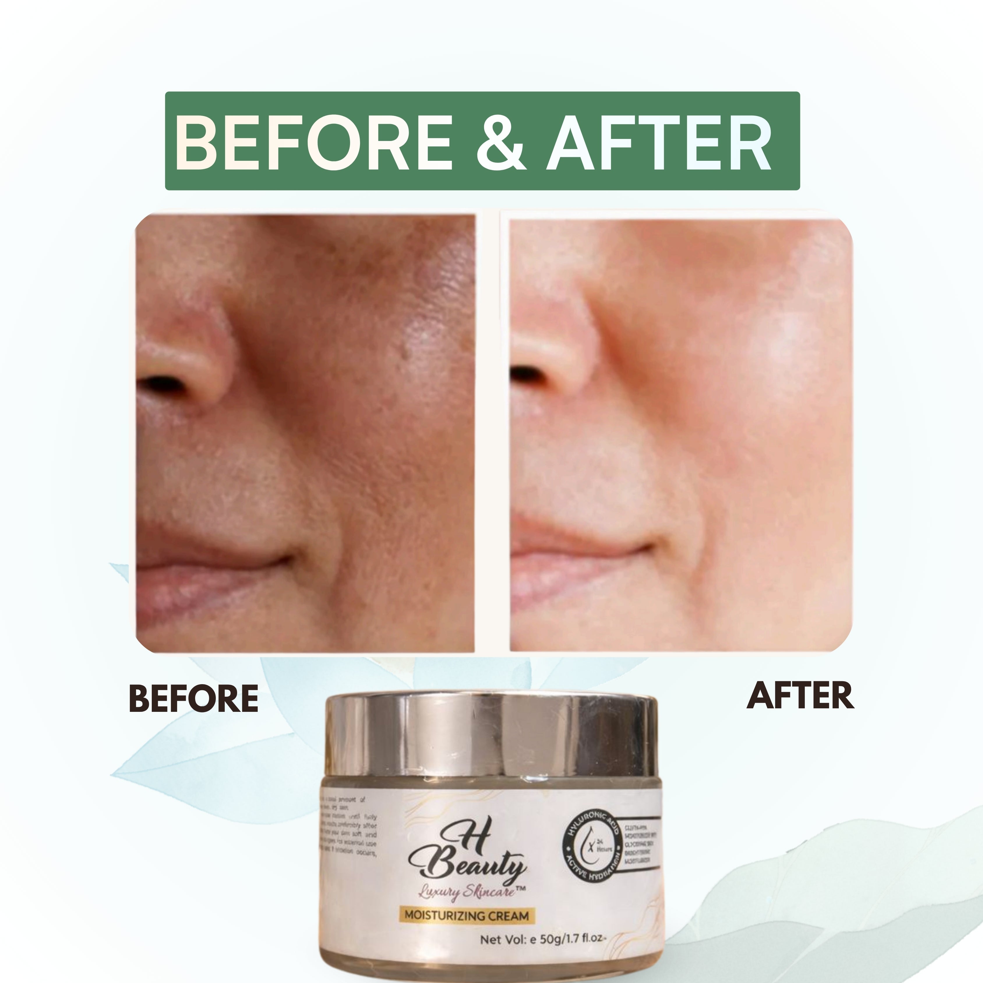 Moisturiser Cream