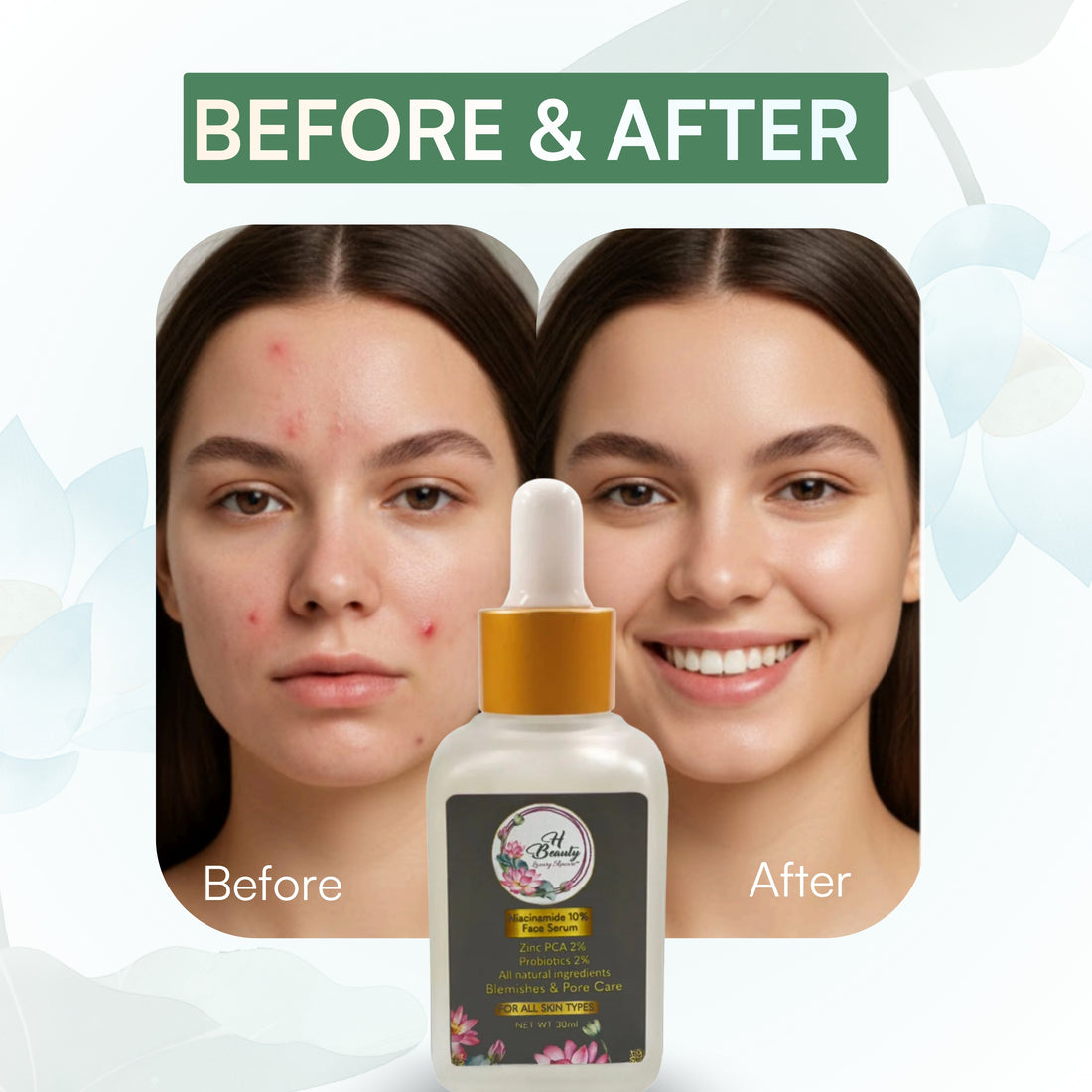 Niacinamide Serum 10%